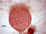 9 –Gametofito maschile con spermatocisti su assi fertili frammisti a tricoblasti